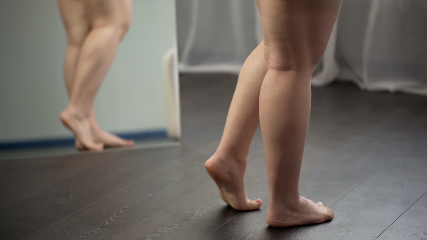 estaño Adulto Contradecir Cómo quitar la celulitis de las piernas y glúteos? | Naturhouse